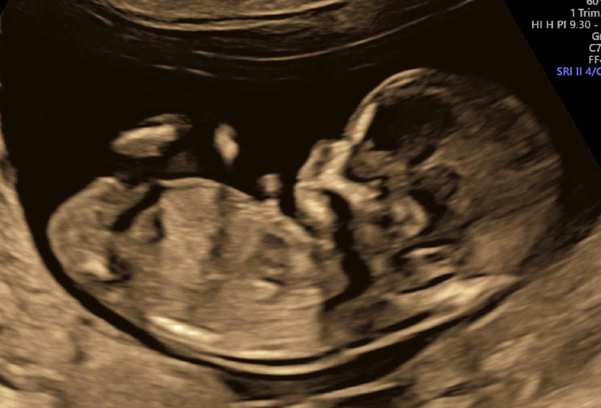 Foto van de nieuwe poet